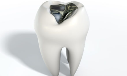 The Truth About Silver Fillings